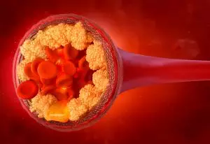 Cholesterol HDL